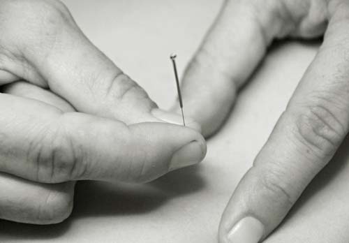 mendocino acupuncture